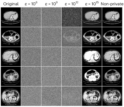 When Optimal is the Enemy of Good: High-Budget Differential Privacy for Medical AI