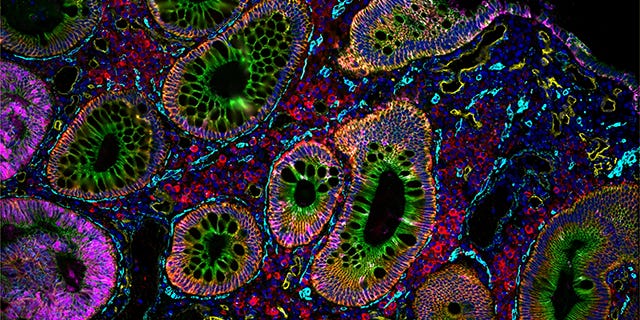 Agents for Spatial Biology