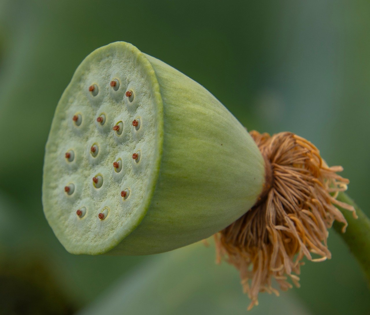 Leveraging Artificial Intelligence for Advanced Diagnostic Analytics to Improve Clinical Decision Support and Diagnostic Accuracy in Hospitals