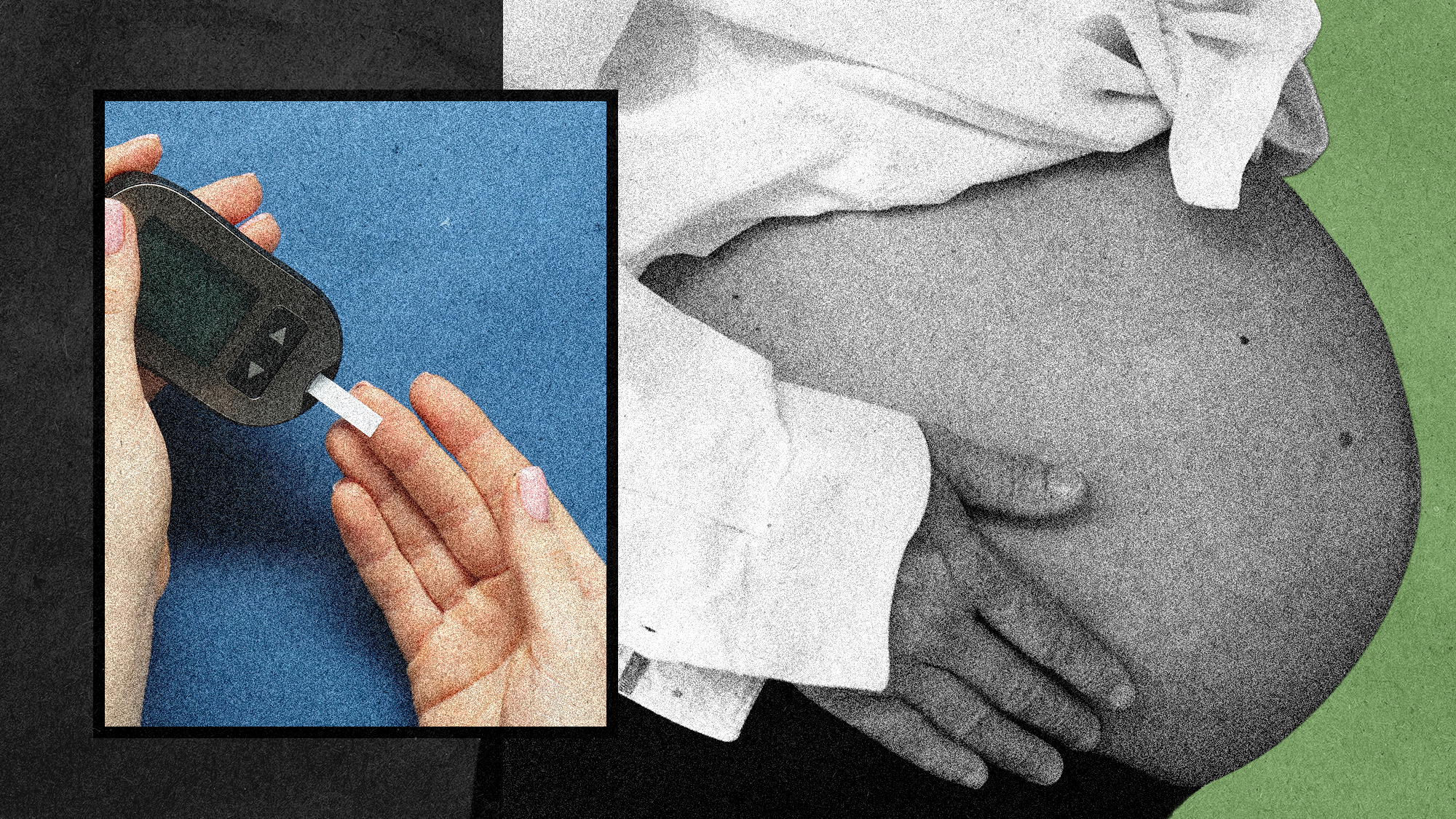 The Largest Undocumented Disparity in Maternal Health